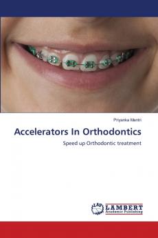 Accelerators In Orthodontics