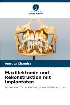 Maxillektomie und Rekonstruktion mit Implantaten