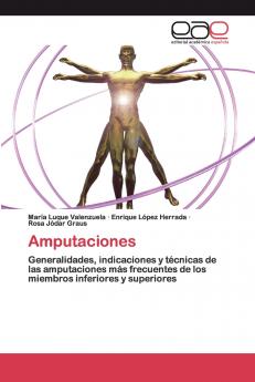 Amputaciones