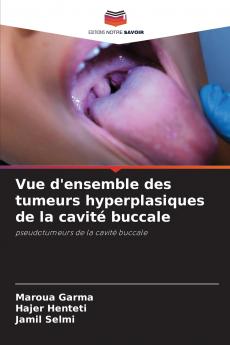 Vue d'ensemble des tumeurs hyperplasiques de la cavité buccale
