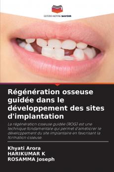 Régénération osseuse guidée dans le développement des sites d'implantation