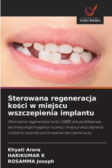 Sterowana regeneracja kości w miejscu wszczepienia implantu