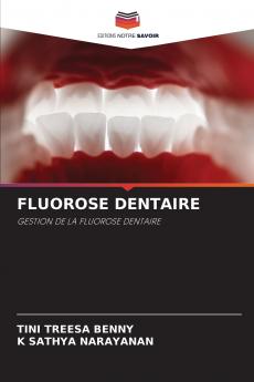 FLUOROSE DENTAIRE