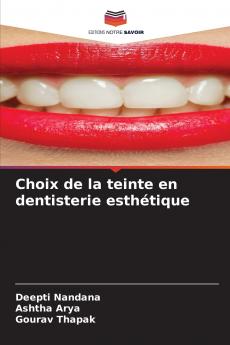 Choix de la teinte en dentisterie esthétique