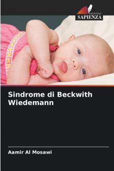 Sindrome di Beckwith Wiedemann