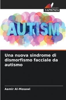 Una nuova sindrome di dismorfismo facciale da autismo