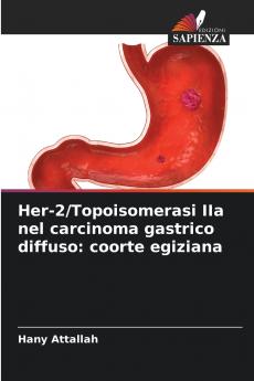 Her-2/Topoisomerasi IIa nel carcinoma gastrico diffuso