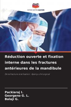 Réduction ouverte et fixation interne dans les fractures antérieures de la mandibule