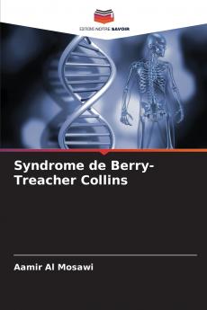 Syndrome de Berry-Treacher Collins