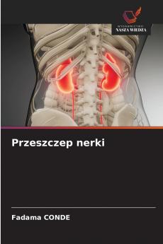Przeszczep nerki