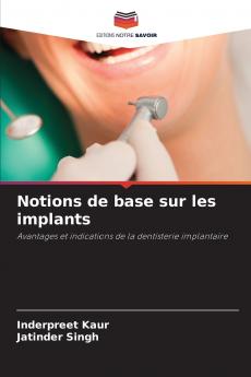 Notions de base sur les implants