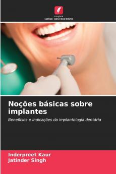 Noções básicas sobre implantes