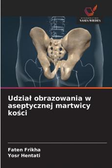 Udział obrazowania w aseptycznej martwicy kości