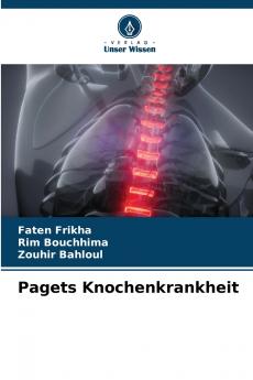 Pagets Knochenkrankheit