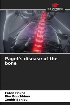 Paget's disease of the bone