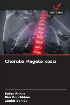 Choroba Pageta kości