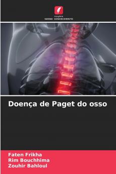 Doença de Paget do osso