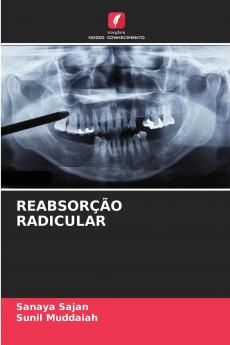 REABSORÇÃO RADICULAR