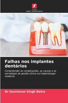 Falhas nos implantes dentários