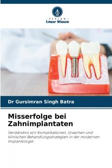 Misserfolge bei Zahnimplantaten