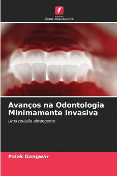 Avanços na Odontologia Minimamente Invasiva