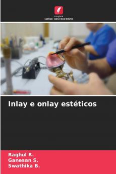Inlay e onlay estéticos