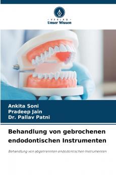 Behandlung von gebrochenen endodontischen Instrumenten