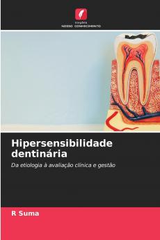Hipersensibilidade dentinária