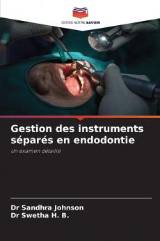 Gestion des instruments séparés en endodontie