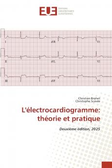 L'électrocardiogramme