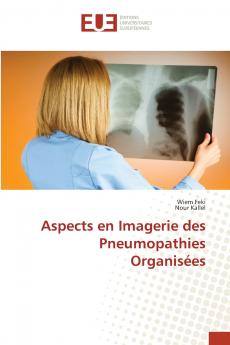 Aspects en Imagerie des Pneumopathies Organisées