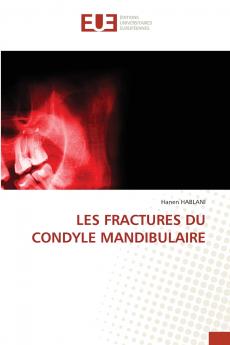 LES FRACTURES DU CONDYLE MANDIBULAIRE