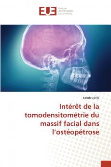 Intérêt de la tomodensitométrie du massif facial dans l'ostéopétrose