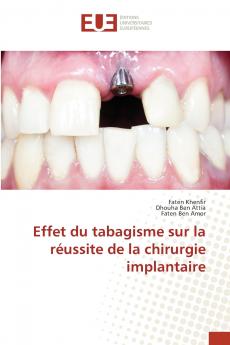 Effet du tabagisme sur la réussite de la chirurgie implantaire