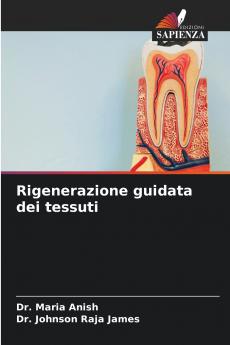 Rigenerazione guidata dei tessuti