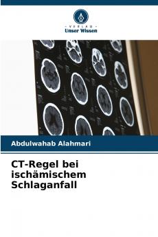 CT-Regel bei ischämischem Schlaganfall