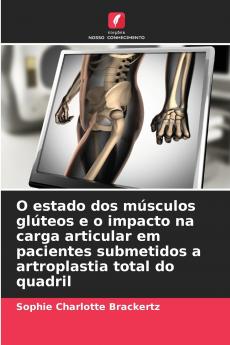 O estado dos músculos glúteos e o impacto na carga articular em pacientes submetidos a artroplastia total do quadril