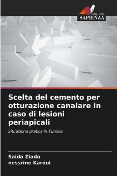 Scelta del cemento per otturazione canalare in caso di lesioni periapicali