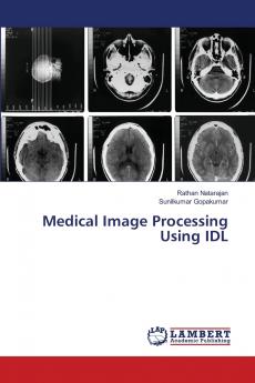 Medical Image Processing Using IDL