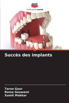 Succès des implants