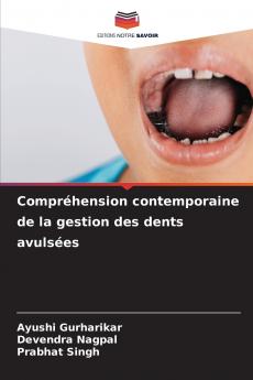 Compréhension contemporaine de la gestion des dents avulsées