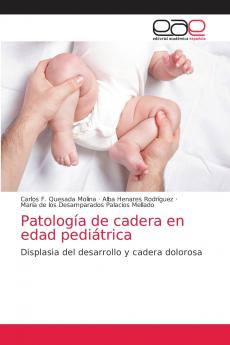 Patología de cadera en edad pediátrica