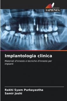 Implantologia clinica