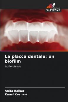 La placca dentale