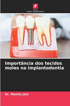 Importância dos tecidos moles na implantodontia