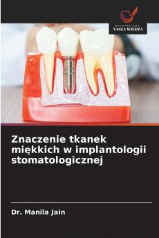 Znaczenie tkanek mi?kkich w implantologii stomatologicznej