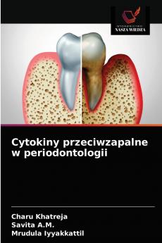 Cytokiny przeciwzapalne w periodontologii
