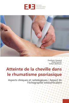 Atteinte de la cheville dans le rhumatisme psoriasique