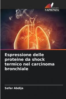 Espressione delle proteine da shock termico nel carcinoma bronchiale