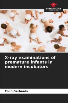 X-ray examinations of premature infants in modern incubators
